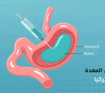 بوتوكس في المعدة في تركيا: الخطوات والفوائد والأسعار