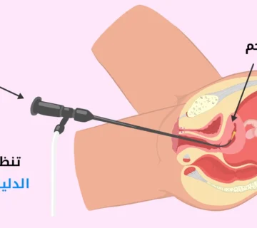 تنظير الرحم: الدليل الشامل للأنواع والخطوات والفوائد