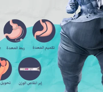 دليل أنواع عمليات السمنة والتكلفة والمميزات