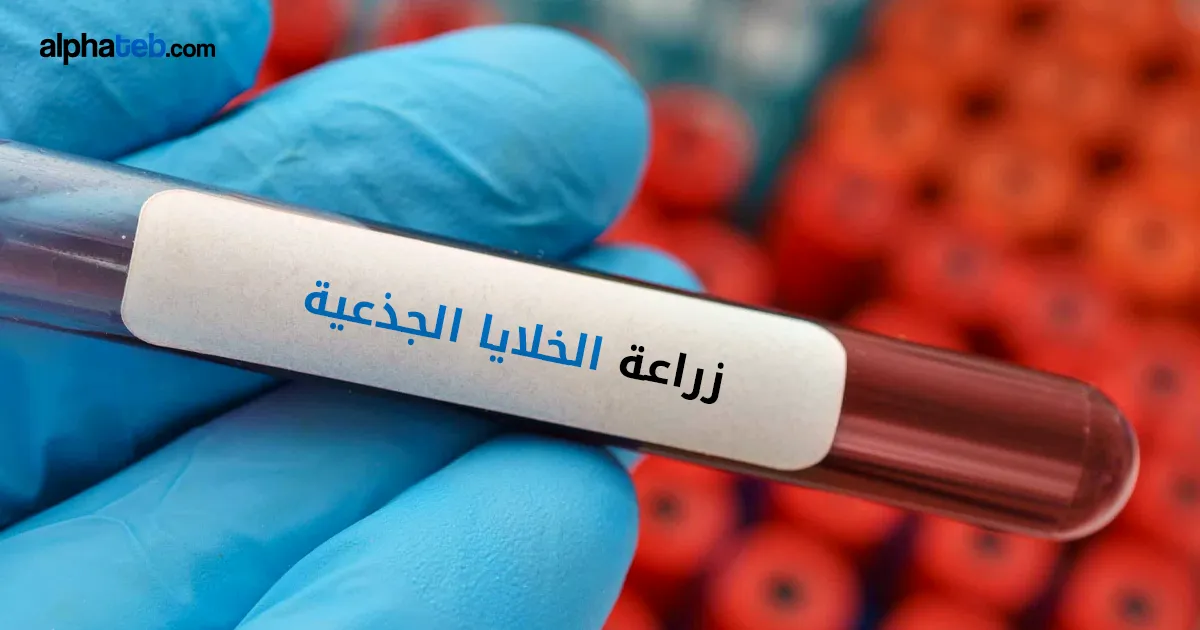 زراعة الخلايا الجذعية: الأنواع والفوائد والنتائج