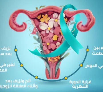 سرطان الرحم: الأعراض والأسباب وأحدث طرق العلاج