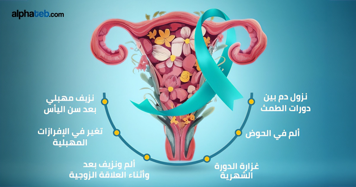 سرطان الرحم: الأعراض والأسباب وأحدث طرق العلاج