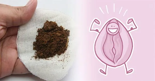 بدائل عملية تجميل المهبل