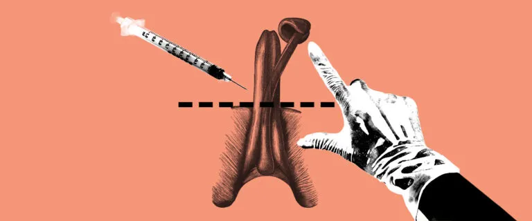 تجميل الأعضاء التناسلية الذكرية