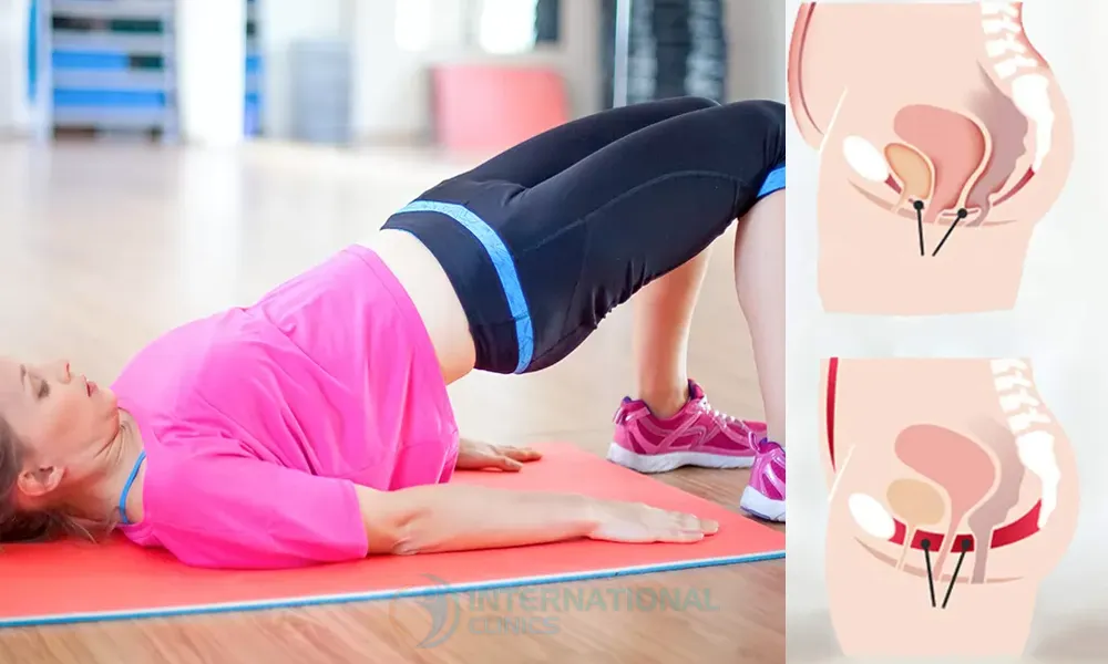 عمليات تجميل المهبل في تركيا
