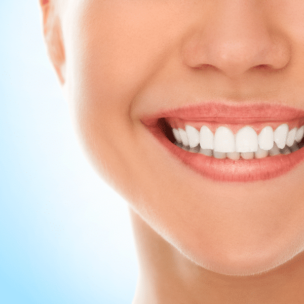 ابتسامة هوليود وتجميل الأسنان .. علاج الأسنان في تركيا