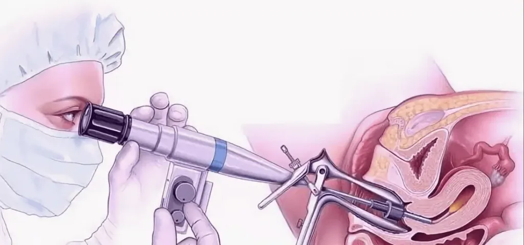 علاج تنظير الرحم
