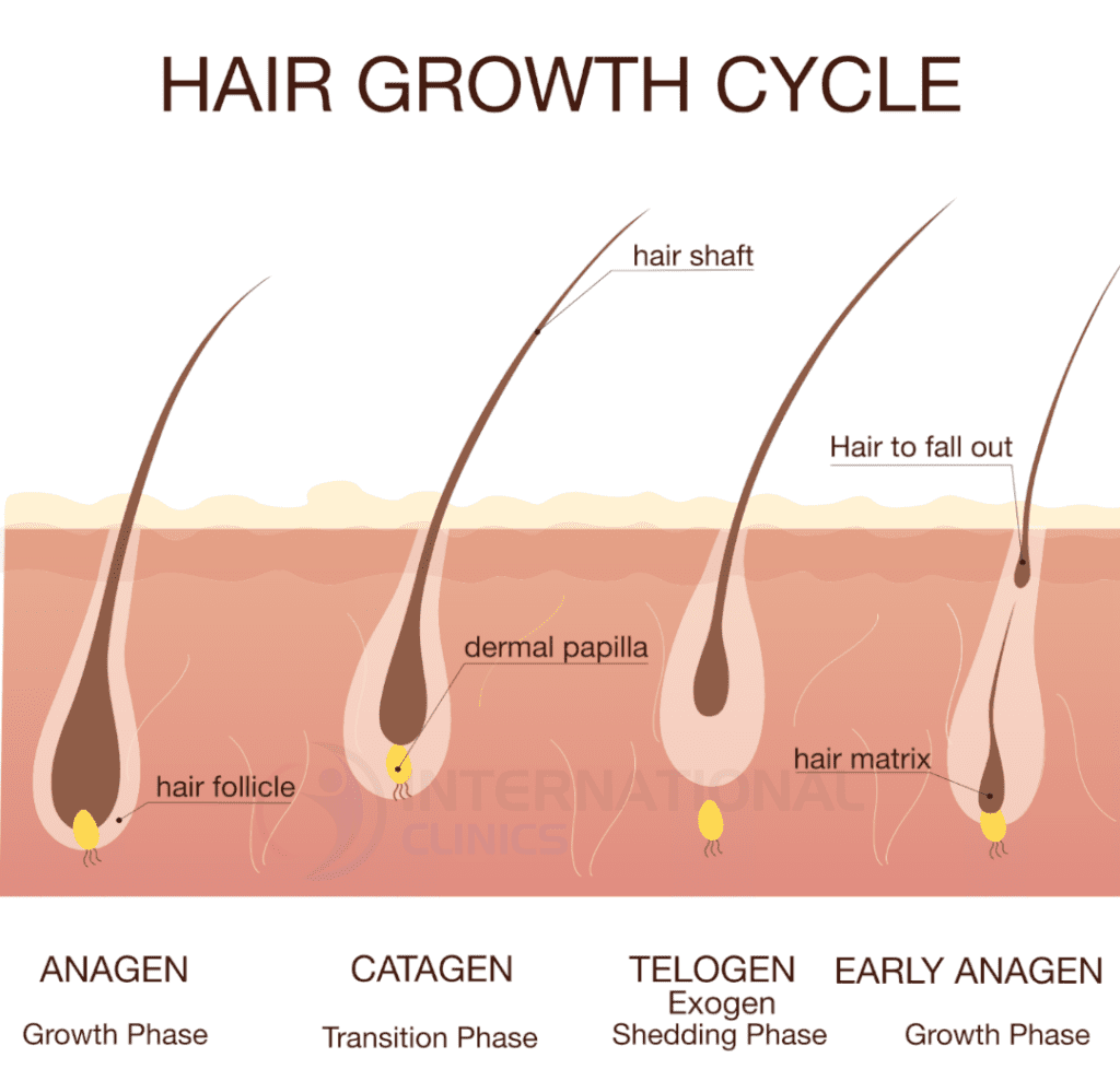 التعافي بعد زراعة الشعر