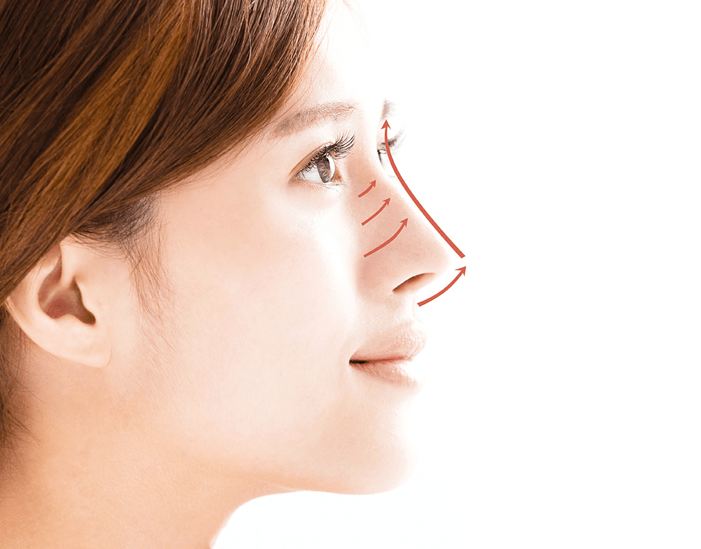 تخطيط تجميل الأنف ثلاثي الأبعاد