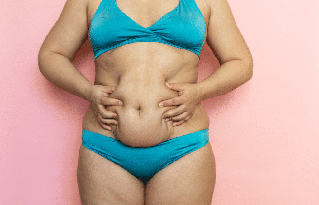 التعافي بعد عملية تجميل البطن
