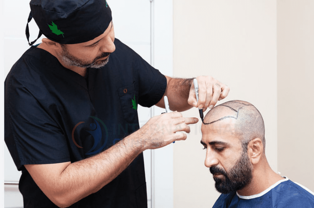 ما هي الحالات المناسبة لإجراء عملية زراعة الشعر بتنقية النانو ؟