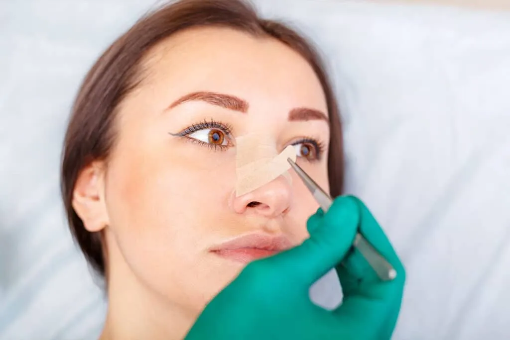 تجميل الأنف اللحمي