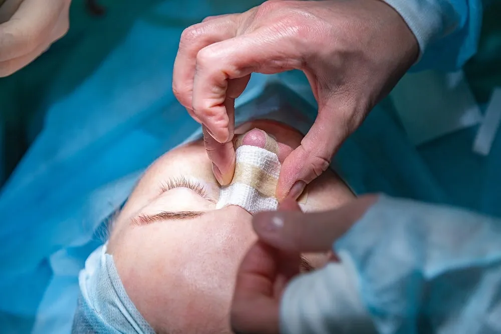 تجربتي مع عملية تجميل الأنف