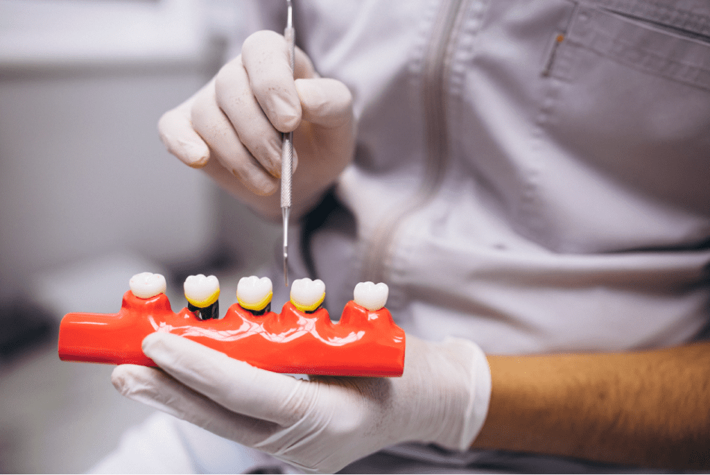 يجب على الطبيب فحص أسنانك قبل تبييض الأسنان بدقة 