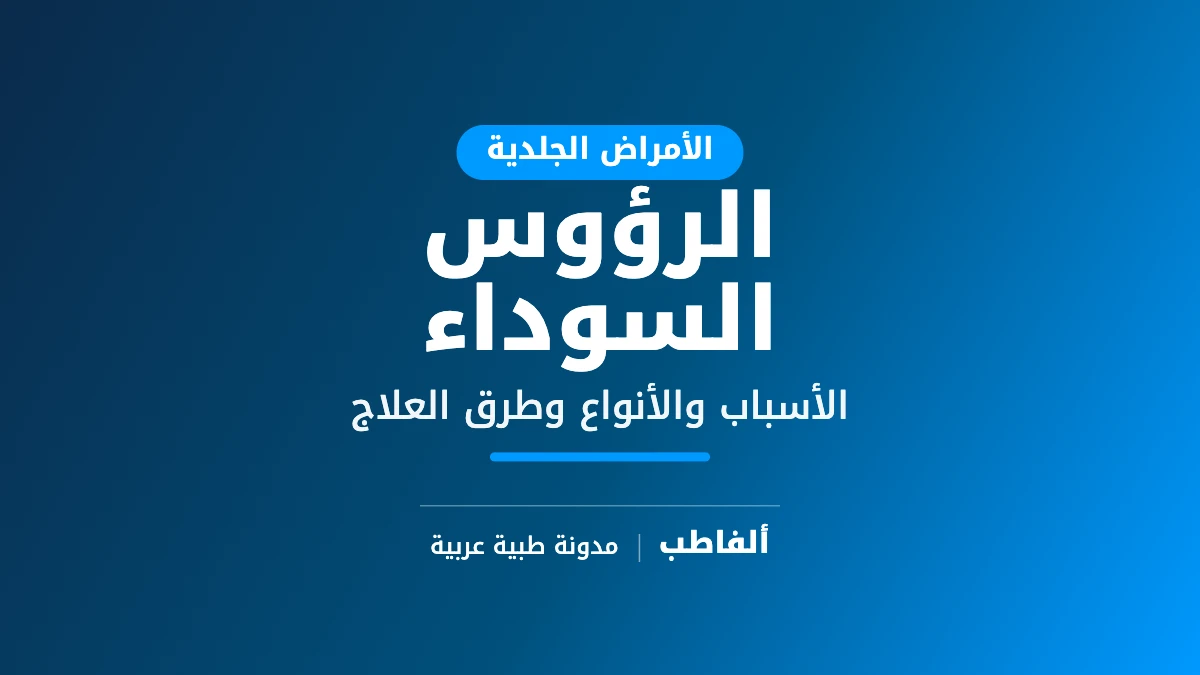 الرؤوس السوداء