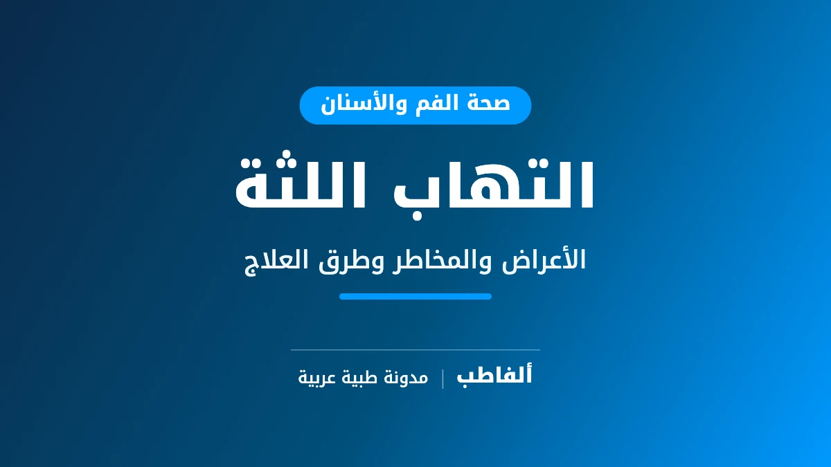 التهاب اللثة