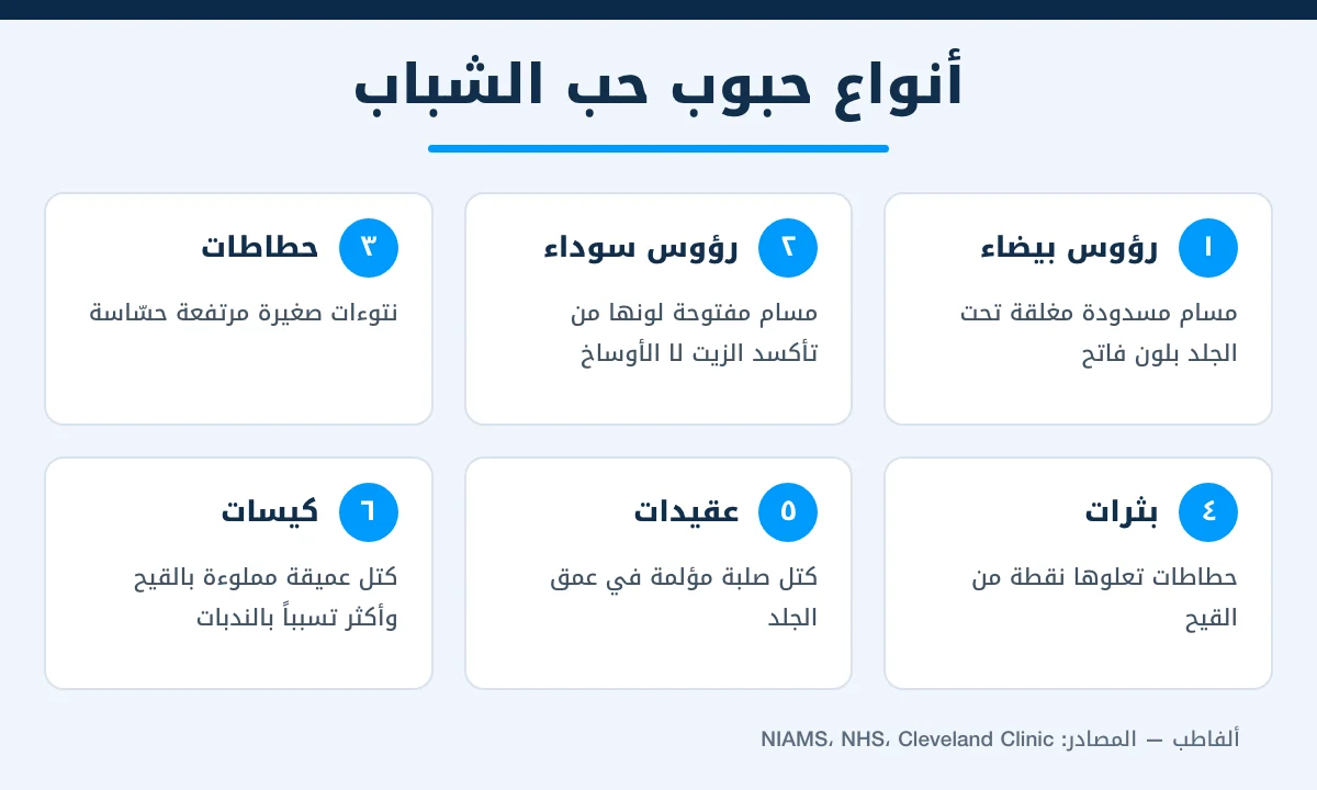 إنفوجرافيك يوضح الأنواع الستة لحبوب حب الشباب من الرؤوس البيضاء إلى الكيسات