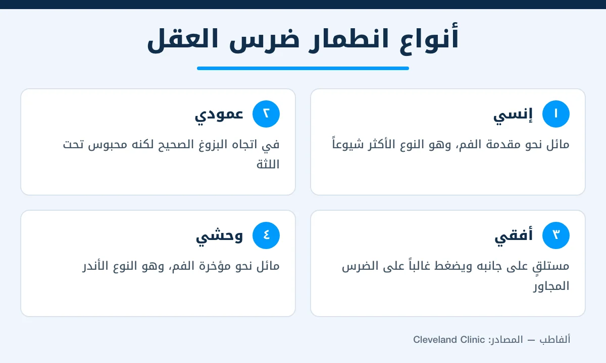 إنفوغرافيك يوضح 4 أنواع لضرس العقل المطمور بحسب اتجاهه: إنسي وعمودي وأفقي ووحشي