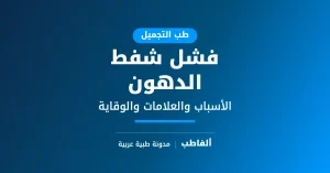 فشل شفط الدهون