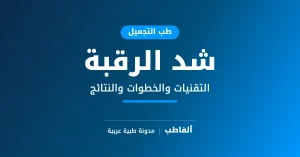شد الرقبة