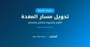 تحويل مسار المعدة