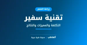تقنية سفير