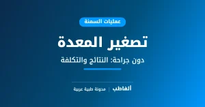 تصغير المعدة