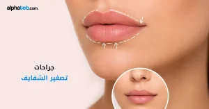 جراحات تصغير الشفايف: تقنيات ونتائج وتكلفة
