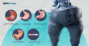 دليل أنواع عمليات السمنة والتكلفة والمميزات