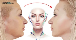 مميزات وعيوب عمليات شد الوجه
